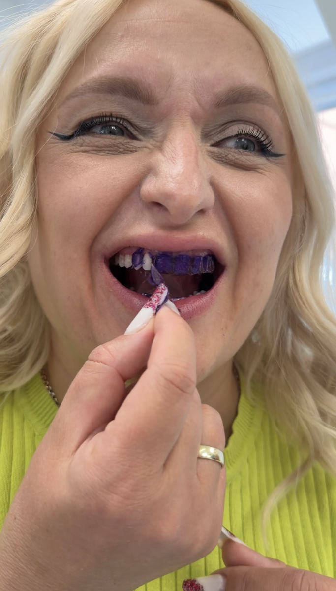 UGC Ad — Ceelike teeth whitening strips